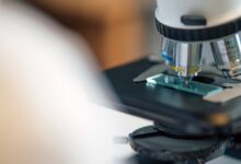 Microscopio de laboratorio con una muestra en la platina